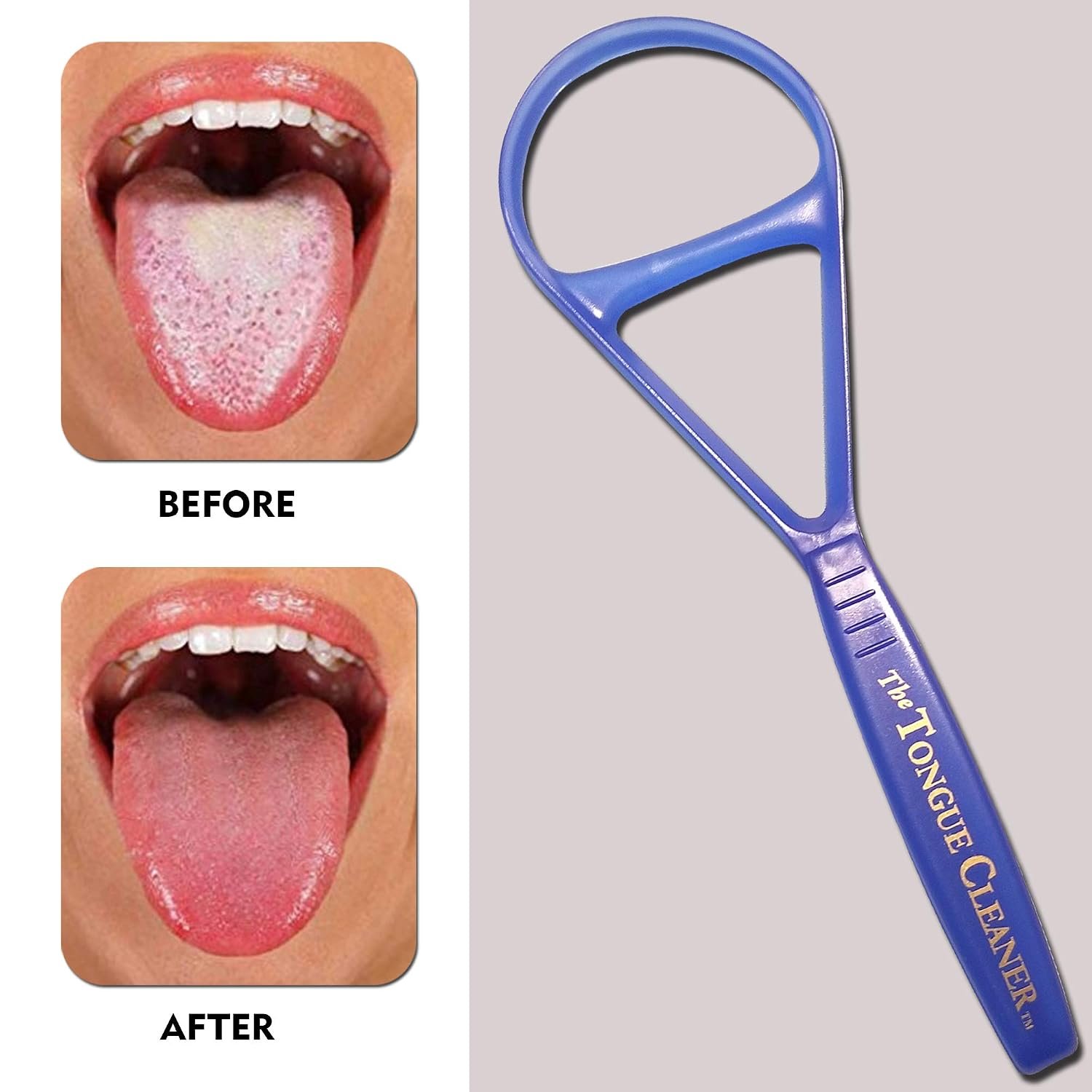 Tongue Scraper Cleaner – the Tongue Cleaner – End Bad Breath and Freshens Breath – Eliminate Bad Breath – Bad Breath Treatment (Color May Vary)